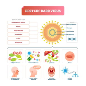 Epstein-Barr-Virus - Pfeiffersche Drüsenfieber