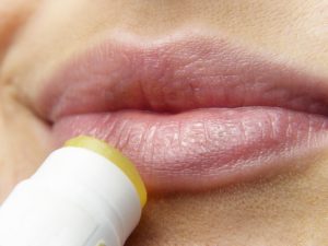 Lippenpflege im Kampf gegen Herpes