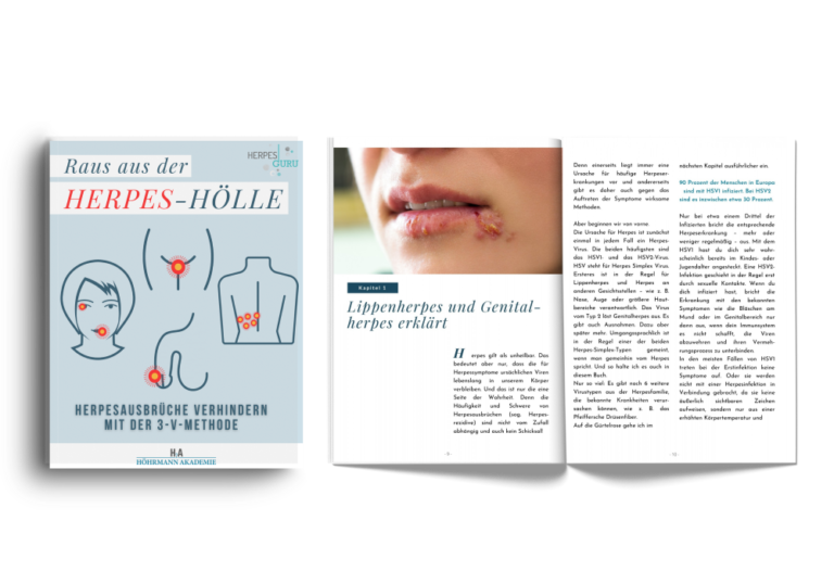 Mit Herpes In Die Sonne herpes-guru.de